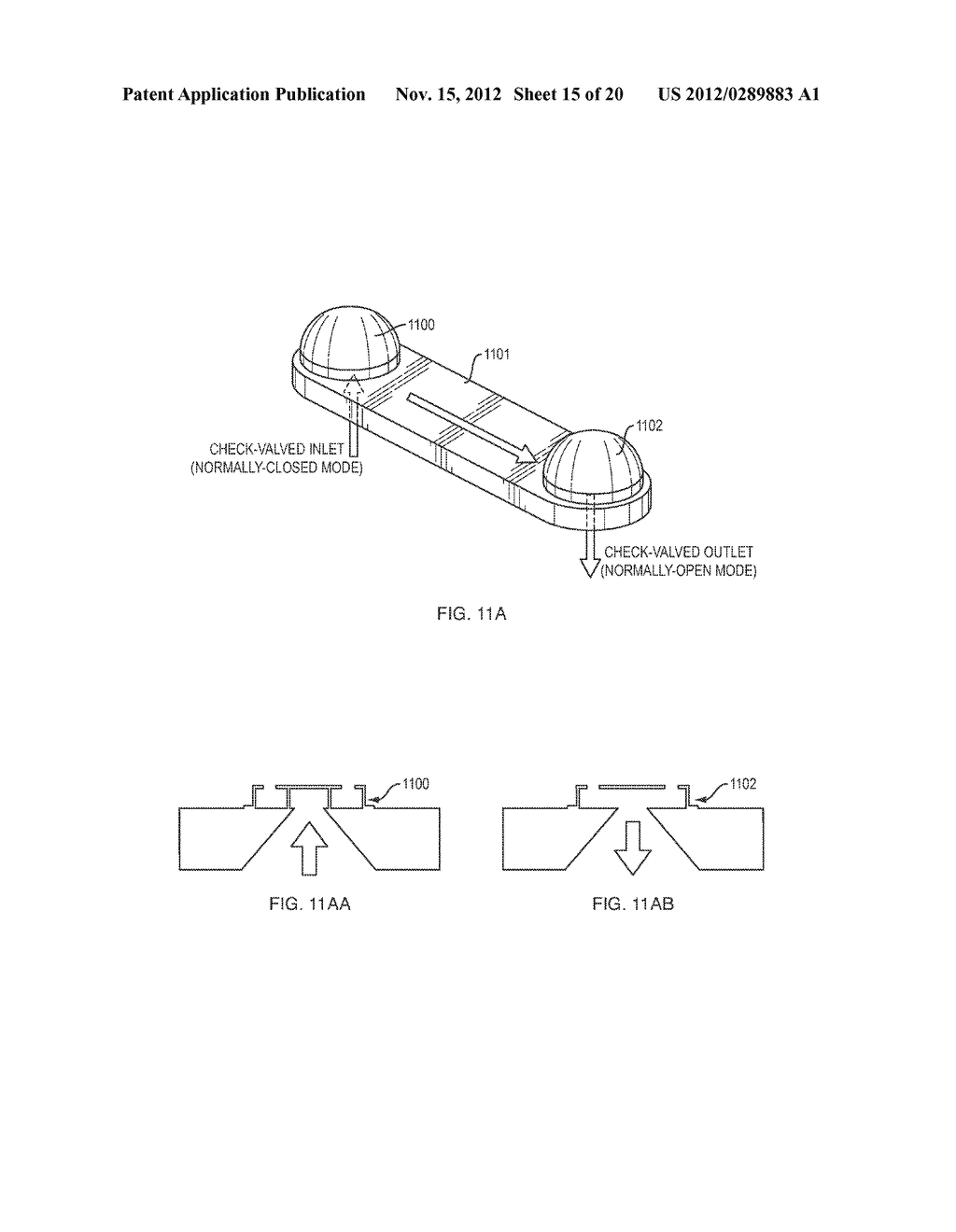 Implantable Intraocular Pressure Drain - diagram, schematic, and image 16