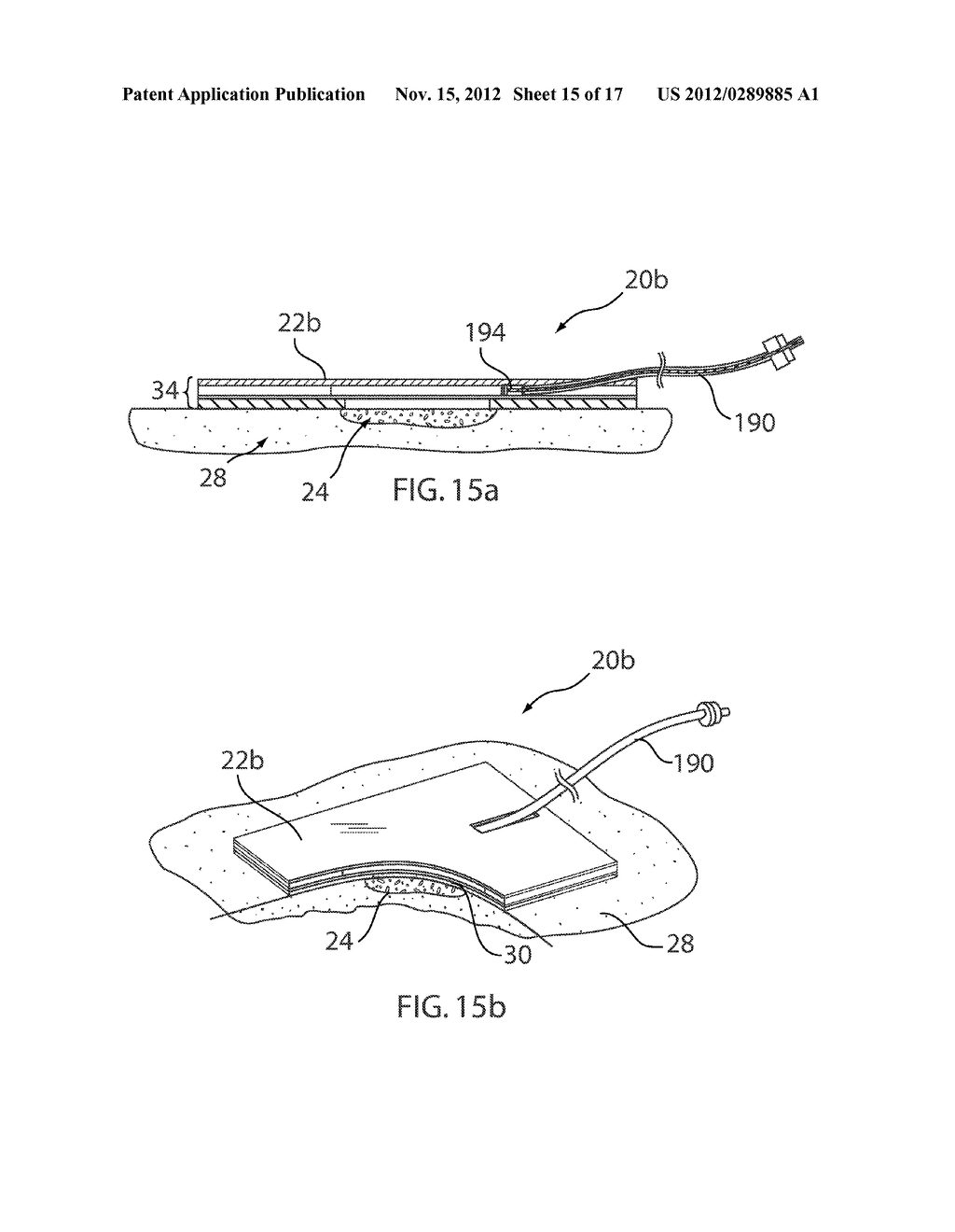 PHOTOTHERAPY SYSTEM - diagram, schematic, and image 16