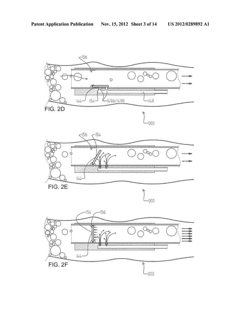 SYSTEMS AND METHODS FOR CLEANING BODY CAVITIES - diagram, schematic, and image 04