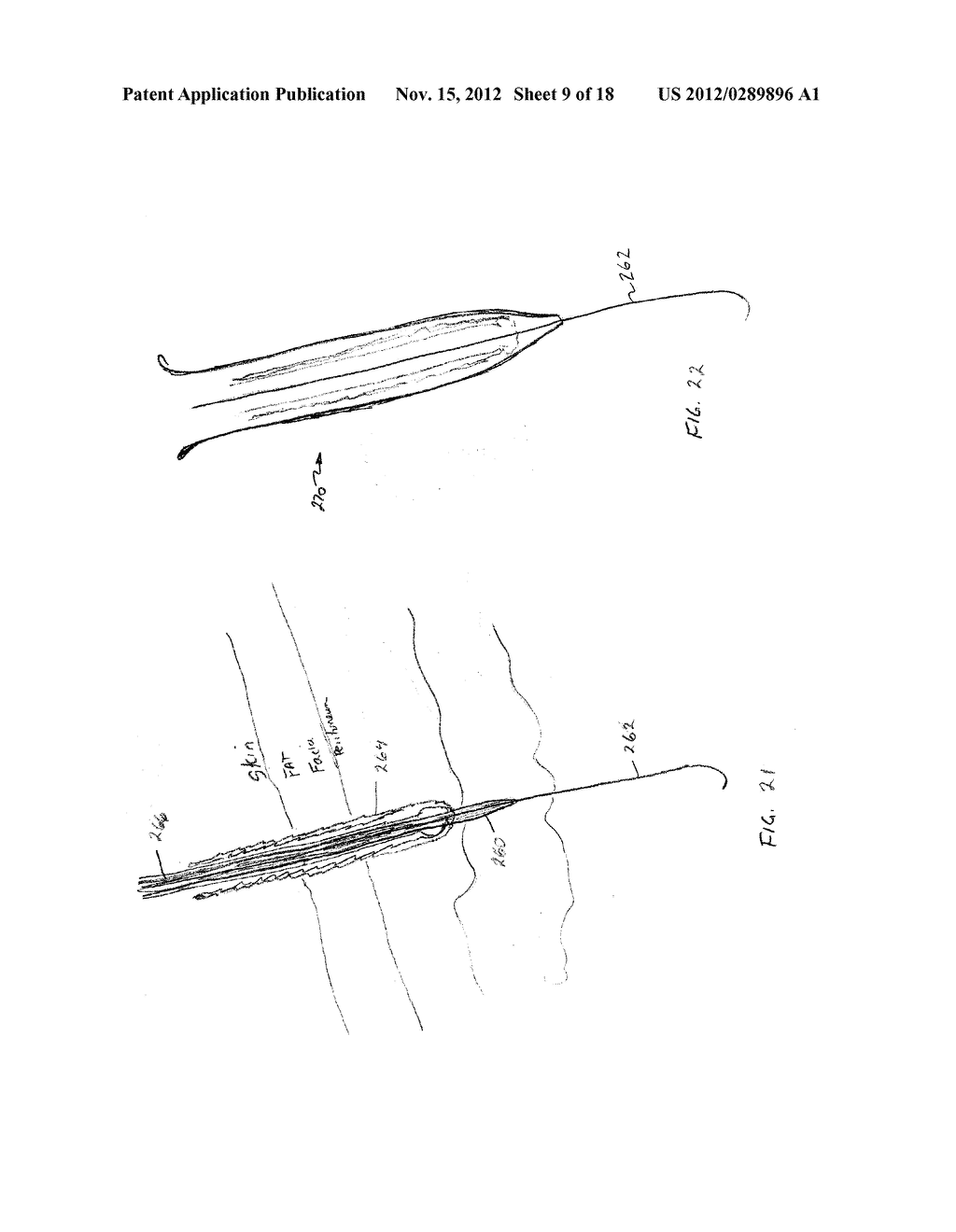 PERCUTANEOUSLY DEPLOYED ABDOMINAL DRAIN - diagram, schematic, and image 10