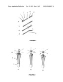 NAVIGABLE SYSTEM FOR CATHETER BASED ENDOVASCULAR NEUROSURGERY diagram and image