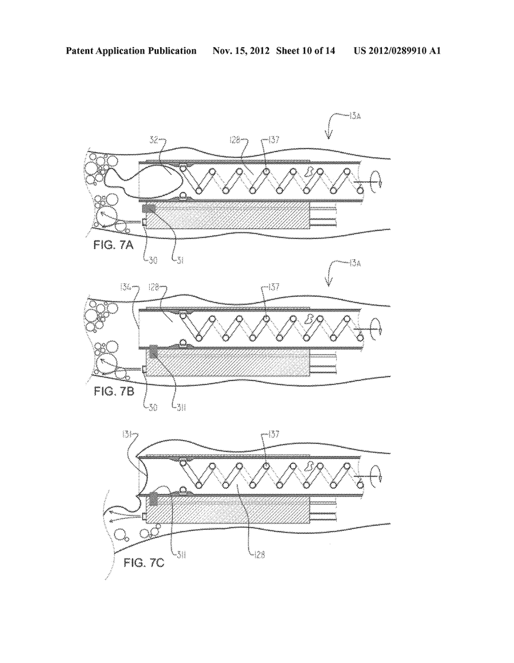 SYSTEMS AND METHODS FOR CLEANING BODY CAVITIES - diagram, schematic, and image 11