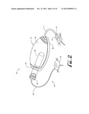 TRANSFER GUARD SYSTEMS AND METHODS diagram and image