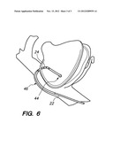 MULTI-BEND STEERABLE MAPPING CATHETER diagram and image