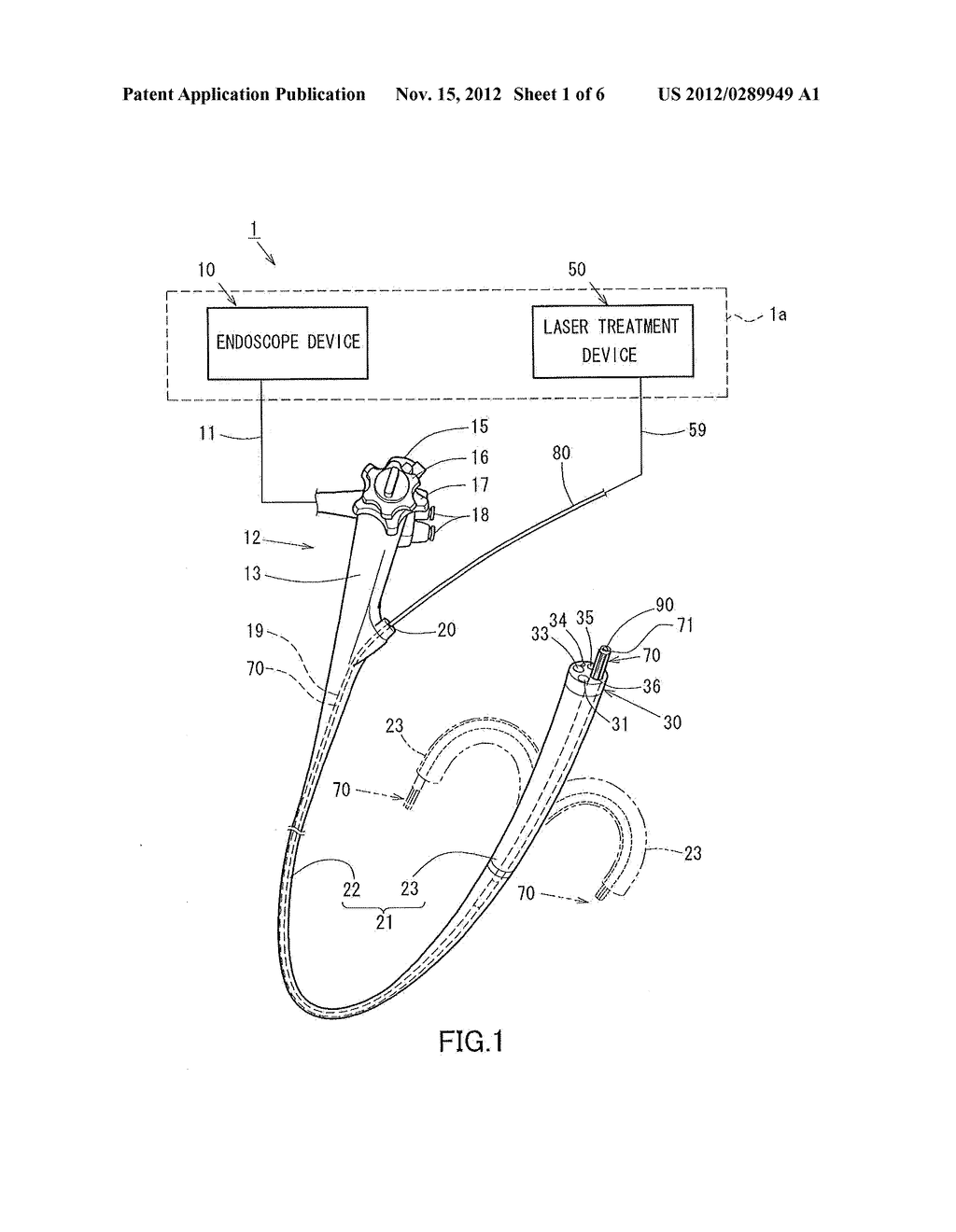 EXTERNAL TUBE, LASER TRANSMISSION PATH, AND LASER TREATMENT TOOL - diagram, schematic, and image 02