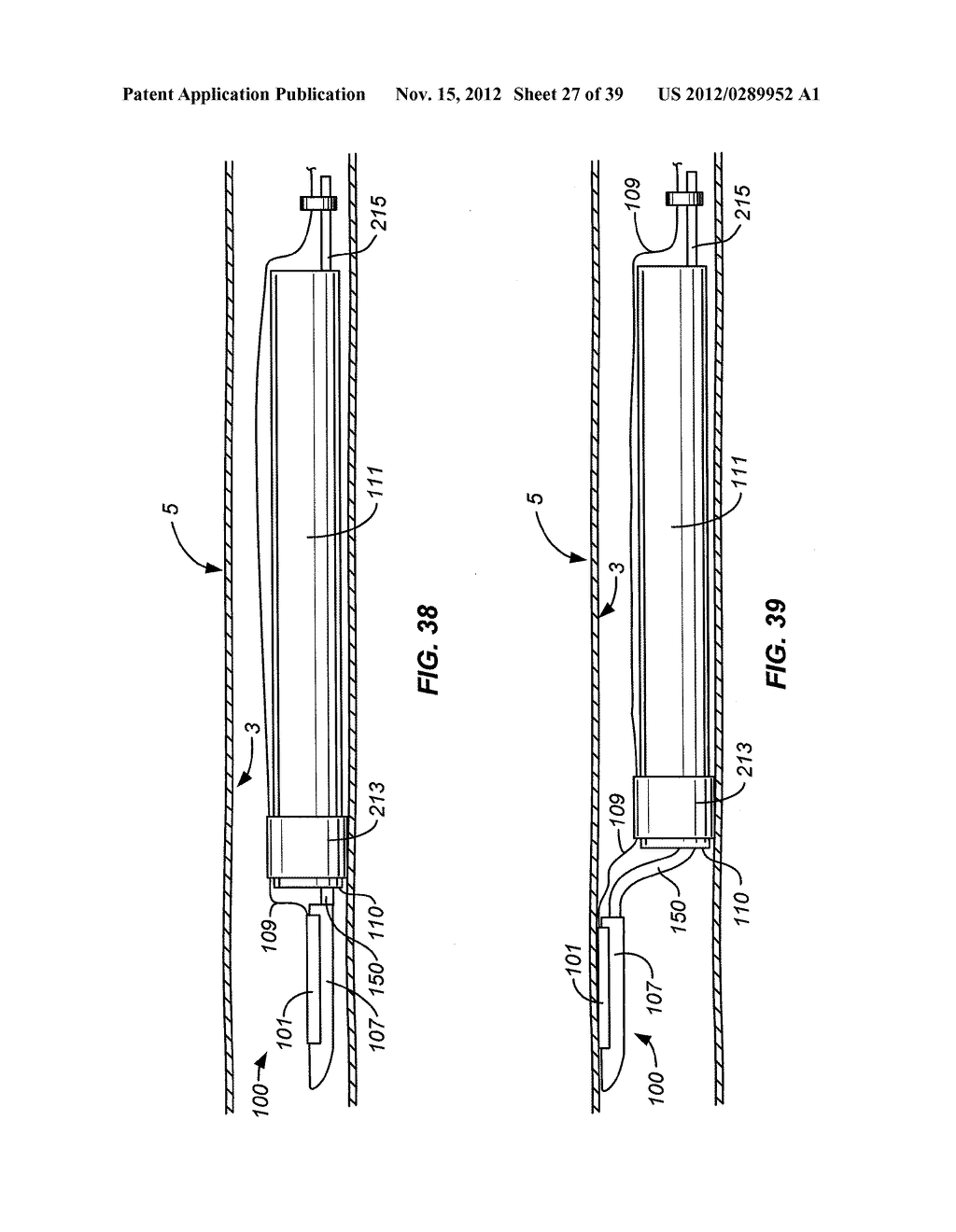 METHOD AND APPARATUS FOR GASTROINTESTINAL TRACT ABLATION TO ACHIEVE LOSS     OF PERSISTENT AND/OR RECURRENT EXCESS BODY WEIGHT FOLLOWING A WEIGHT LOSS     OPERATION - diagram, schematic, and image 28