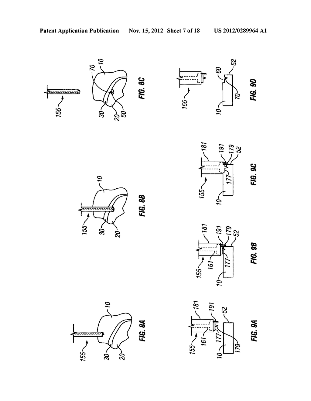 CRANIAL PLATING AND BUR HOLE COVER SYSTEM AND METHODS OF USE - diagram, schematic, and image 08