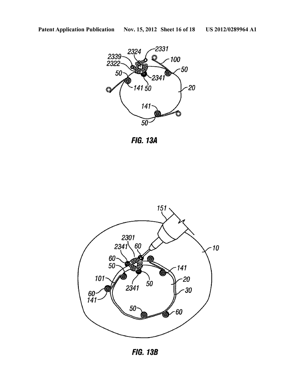 CRANIAL PLATING AND BUR HOLE COVER SYSTEM AND METHODS OF USE - diagram, schematic, and image 17