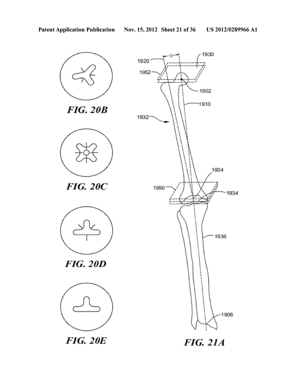 JOINT ARTHROPLASTY DEVICES AND SURGICAL TOOLS - diagram, schematic, and image 22