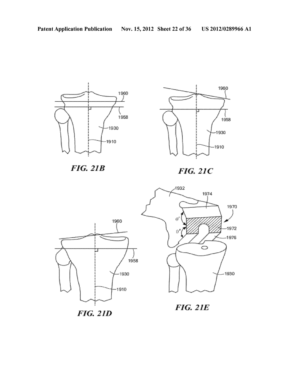 JOINT ARTHROPLASTY DEVICES AND SURGICAL TOOLS - diagram, schematic, and image 23