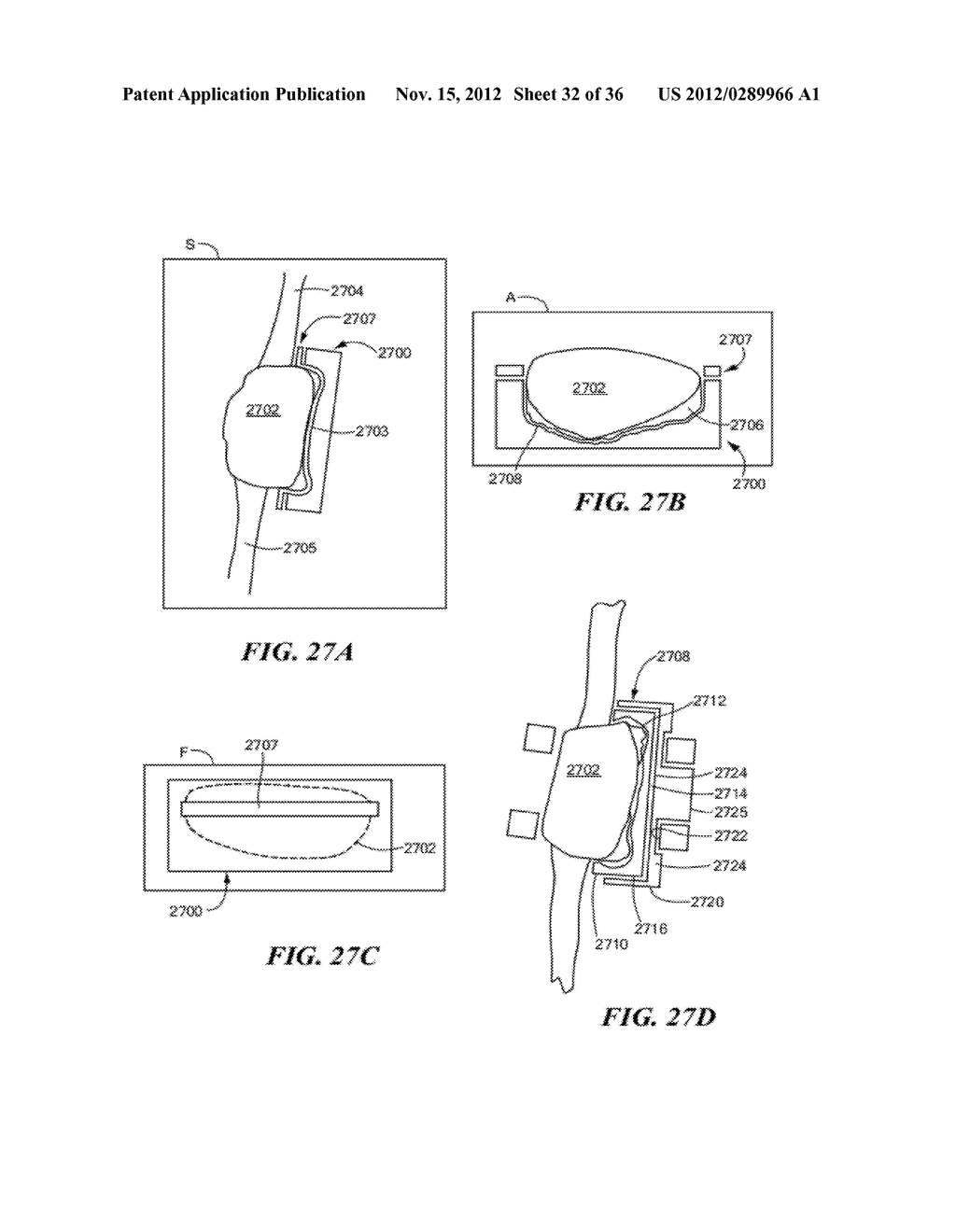 JOINT ARTHROPLASTY DEVICES AND SURGICAL TOOLS - diagram, schematic, and image 33