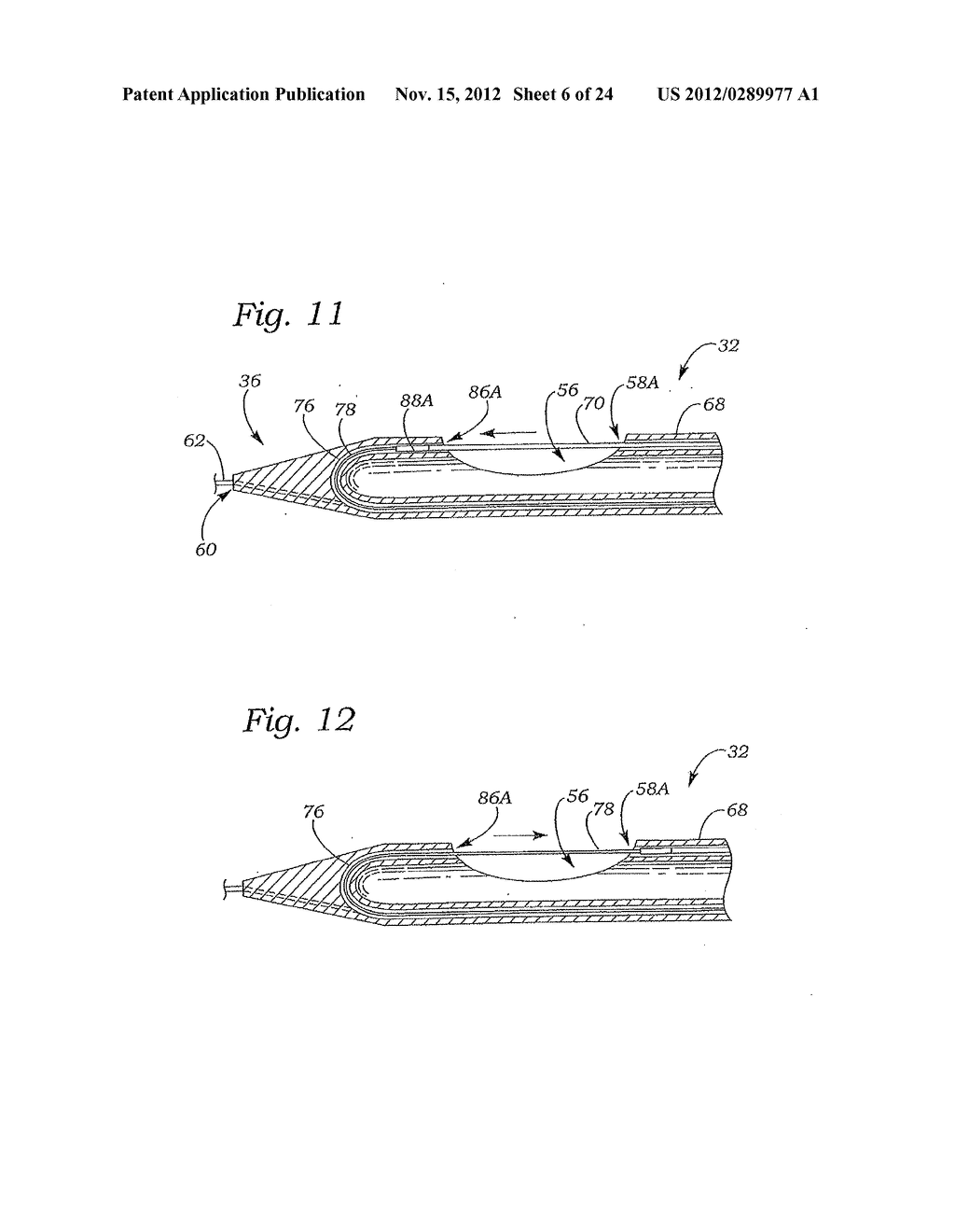MITRAL VALVE REPAIR SYSTEM AND METHOD FOR USE - diagram, schematic, and image 07