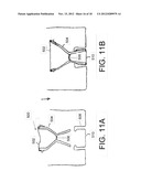 Apparatus for Supplying Surgical Staple Line Reinforcement diagram and image