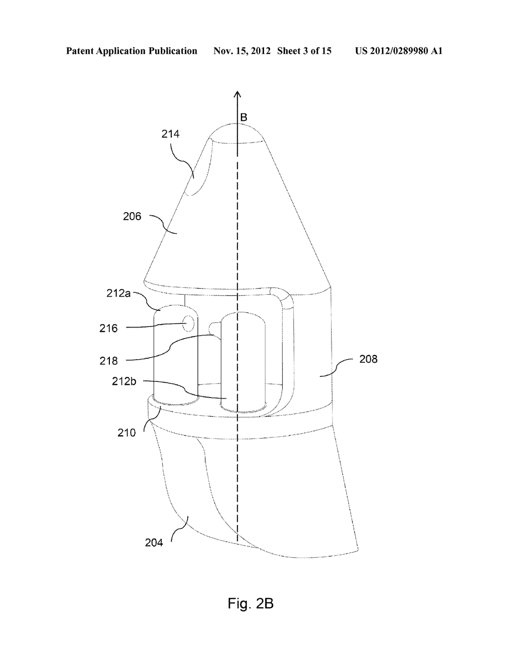ANCHORS FOR BODILY IMPLANTS AND METHODS FOR ANCHORING BODILY IMPLANTS INTO     A PATIENT'S BODY - diagram, schematic, and image 04
