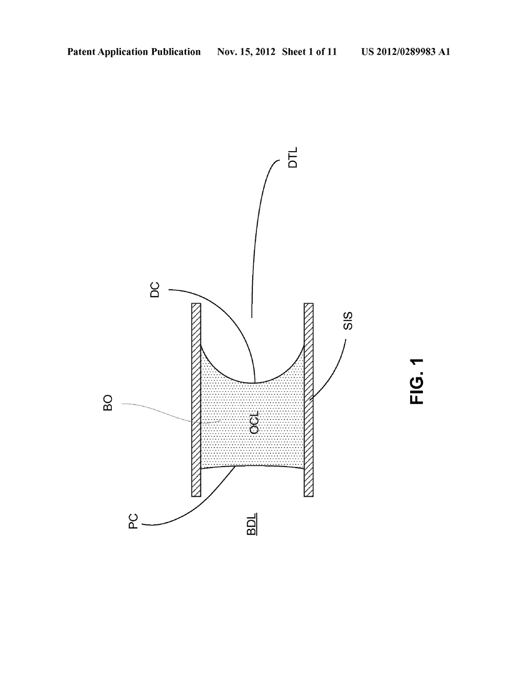 METHODS AND DEVICES FOR RECANALIZATION OF OCCLUDED BODY VESSELS USING A     DOUBLE-SIDED GUIDEWIRE - diagram, schematic, and image 02