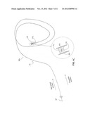 METHODS AND DEVICES FOR RECANALIZATION OF OCCLUDED BODY VESSELS USING A     DOUBLE-SIDED GUIDEWIRE diagram and image