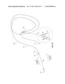 METHODS AND DEVICES FOR RECANALIZATION OF OCCLUDED BODY VESSELS USING A     DOUBLE-SIDED GUIDEWIRE diagram and image