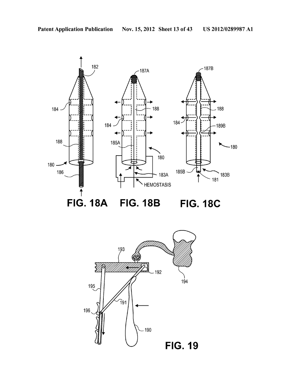 SYSTEMS AND METHODS FOR ENDOLUMINAL VALVE CREATION - diagram, schematic, and image 14