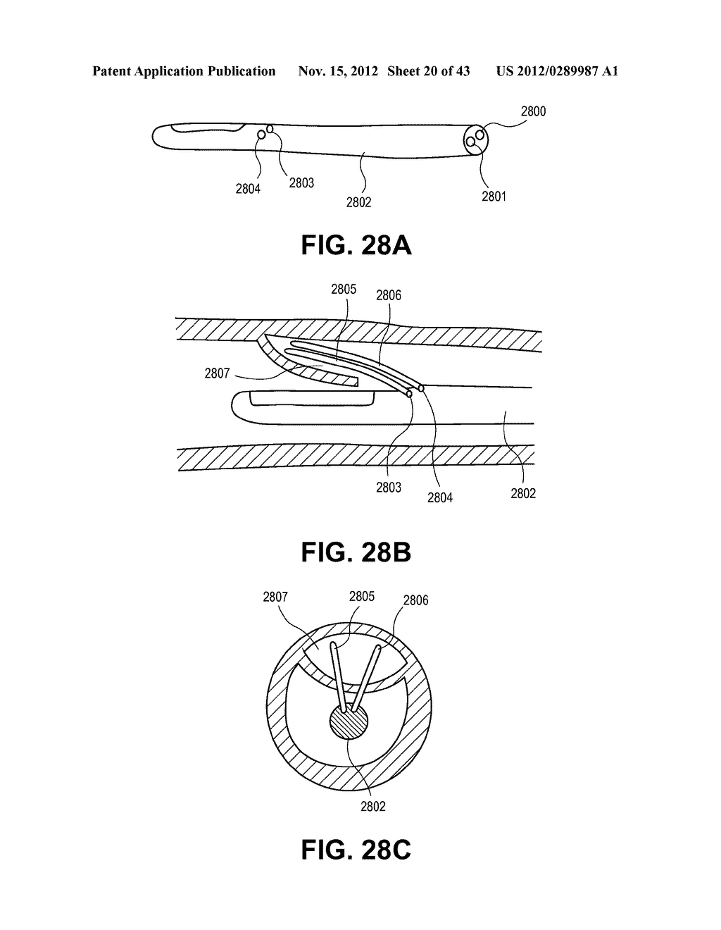 SYSTEMS AND METHODS FOR ENDOLUMINAL VALVE CREATION - diagram, schematic, and image 21