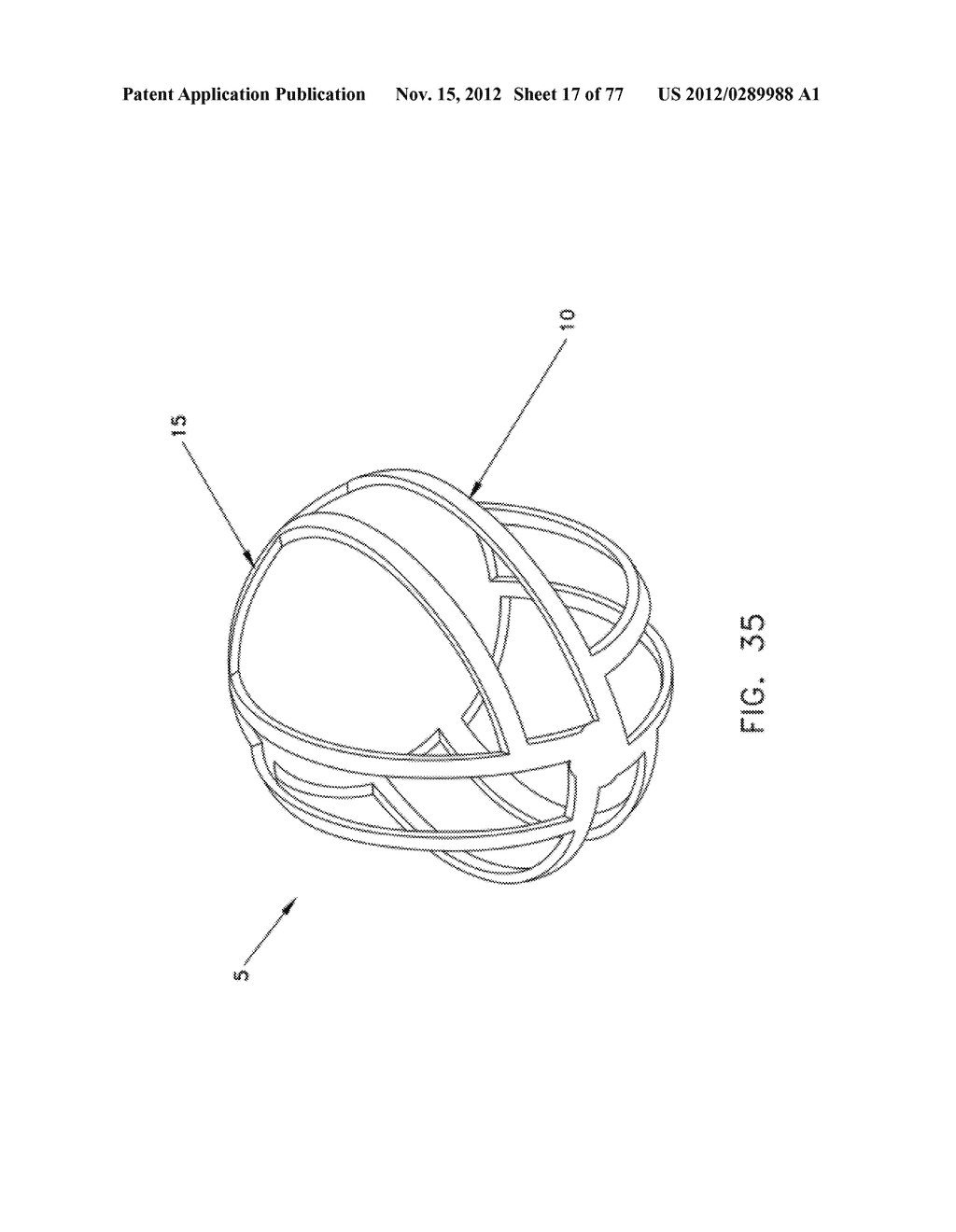 METHOD AND APPARATUS FOR RESTRICTING FLOW THROUGH AN OPENING IN THE SIDE     WALL OF A BODY LUMEN, AND/OR FOR REINFORCING A WEAKNESS IN THE SIDE WALL     OF A BODY LUMEN, WHILE STILL MAINTAINING SUBSTANTIALLY NORMAL FLOW     THROUGH THE BODY LUMEN - diagram, schematic, and image 18