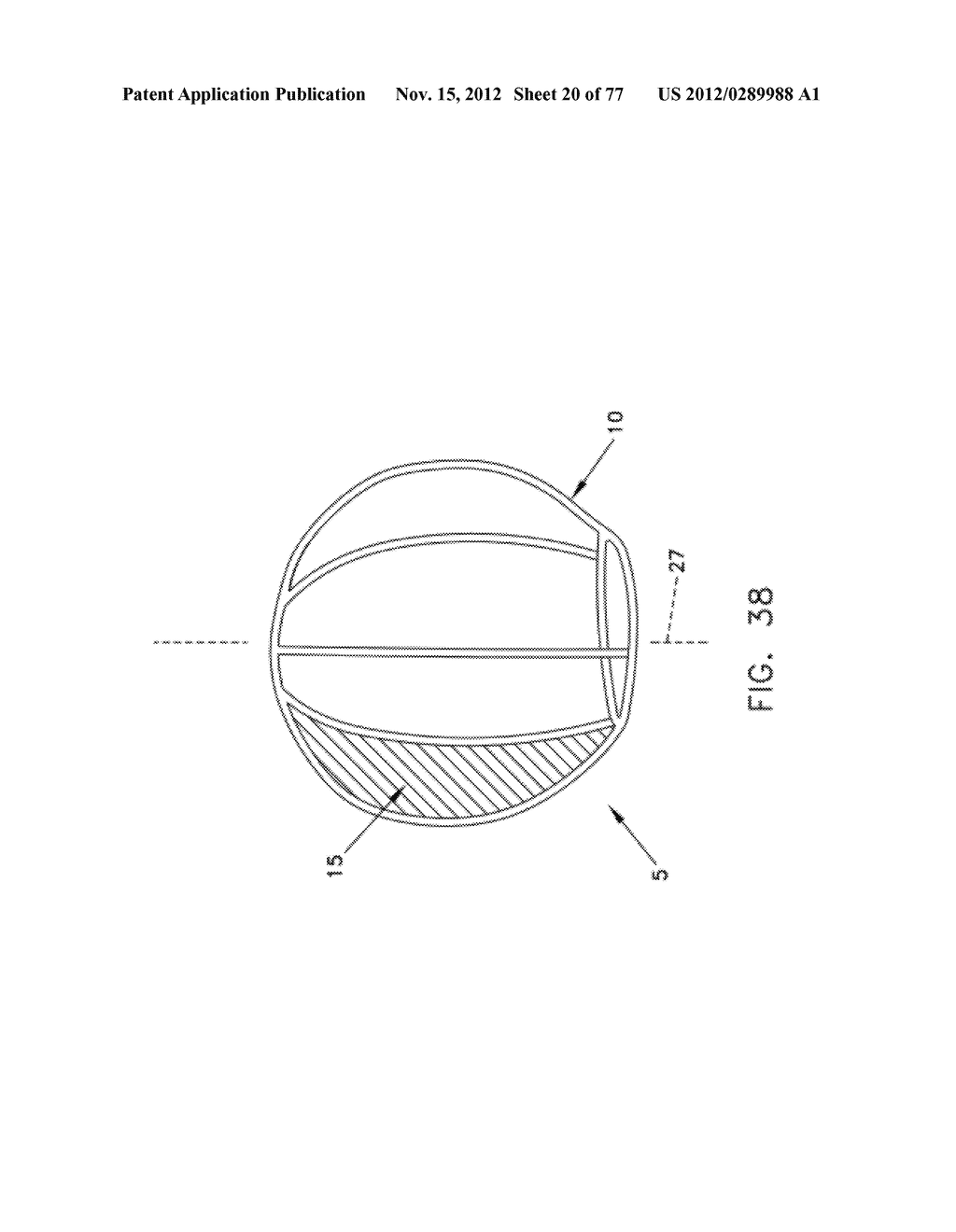 METHOD AND APPARATUS FOR RESTRICTING FLOW THROUGH AN OPENING IN THE SIDE     WALL OF A BODY LUMEN, AND/OR FOR REINFORCING A WEAKNESS IN THE SIDE WALL     OF A BODY LUMEN, WHILE STILL MAINTAINING SUBSTANTIALLY NORMAL FLOW     THROUGH THE BODY LUMEN - diagram, schematic, and image 21