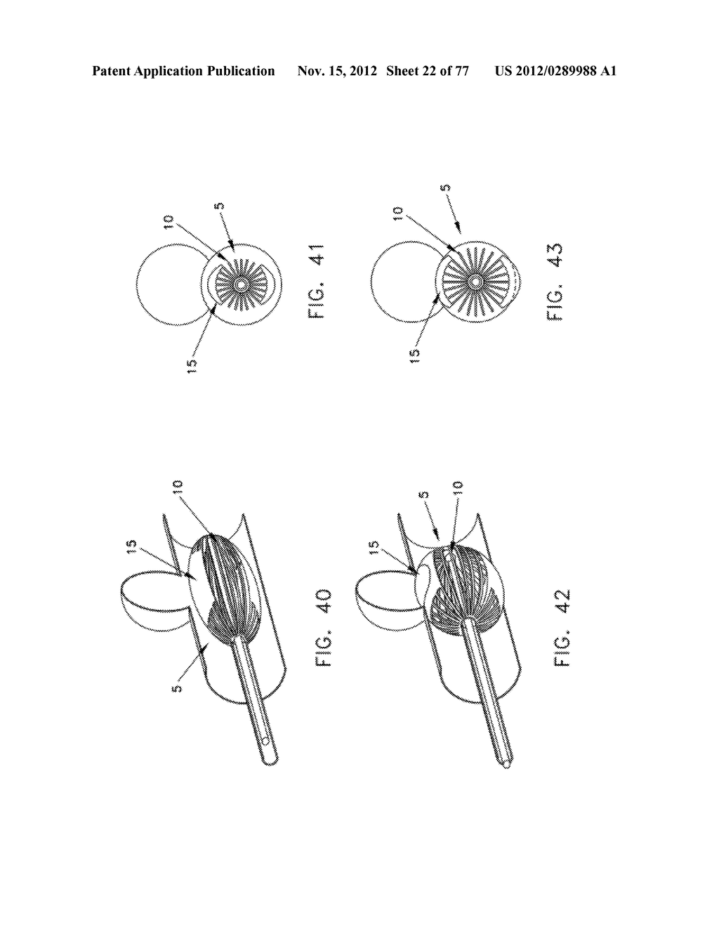 METHOD AND APPARATUS FOR RESTRICTING FLOW THROUGH AN OPENING IN THE SIDE     WALL OF A BODY LUMEN, AND/OR FOR REINFORCING A WEAKNESS IN THE SIDE WALL     OF A BODY LUMEN, WHILE STILL MAINTAINING SUBSTANTIALLY NORMAL FLOW     THROUGH THE BODY LUMEN - diagram, schematic, and image 23