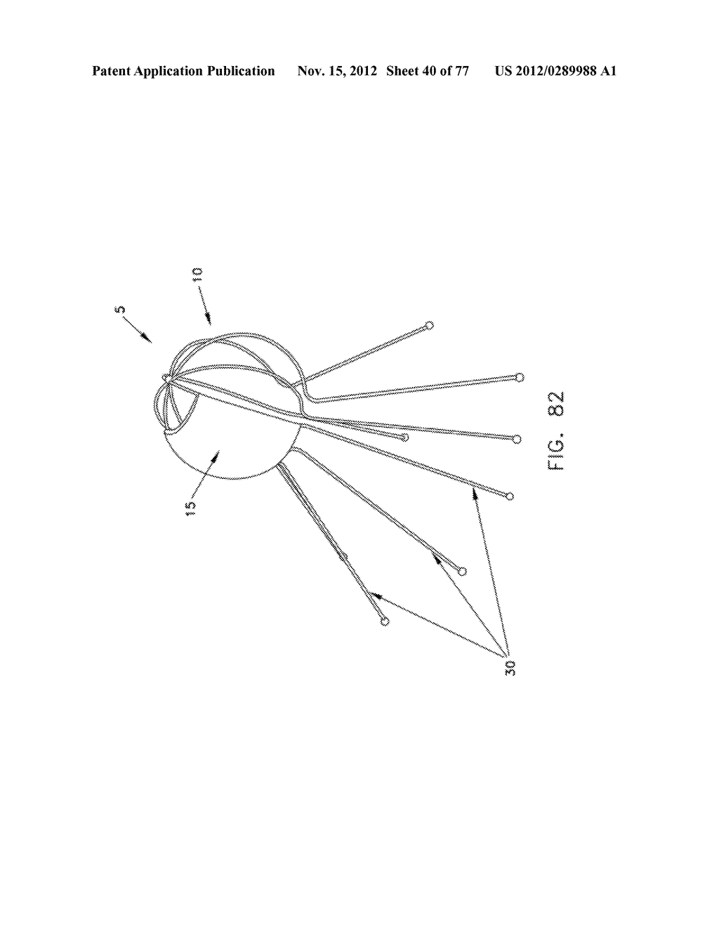 METHOD AND APPARATUS FOR RESTRICTING FLOW THROUGH AN OPENING IN THE SIDE     WALL OF A BODY LUMEN, AND/OR FOR REINFORCING A WEAKNESS IN THE SIDE WALL     OF A BODY LUMEN, WHILE STILL MAINTAINING SUBSTANTIALLY NORMAL FLOW     THROUGH THE BODY LUMEN - diagram, schematic, and image 41