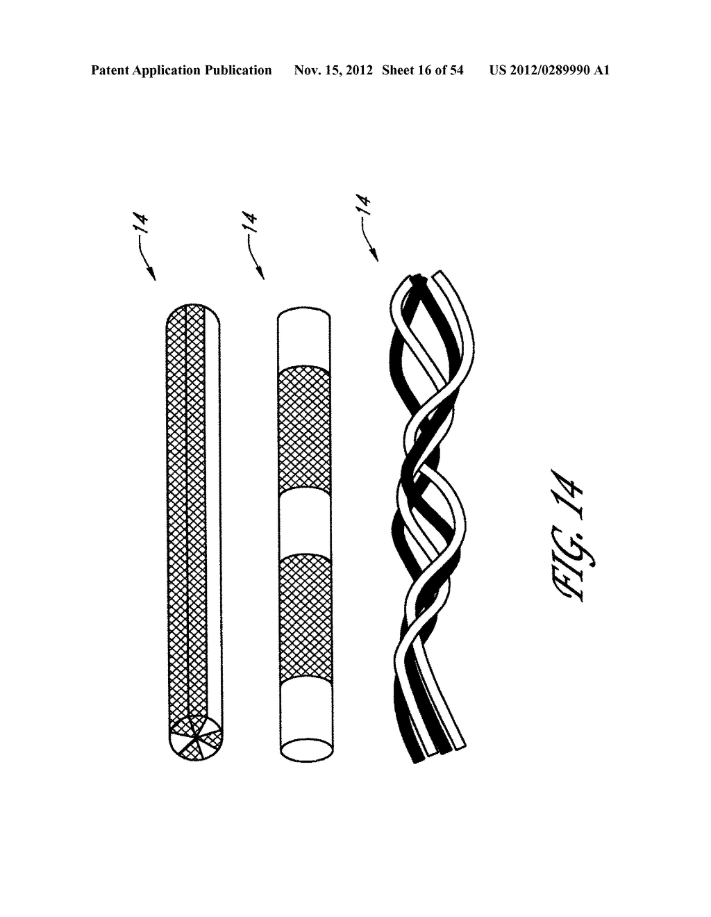 STRUCTURES FOR PERMANENT OCCLUSION OF A HOLLOW ANATOMICAL STRUCTURE - diagram, schematic, and image 17