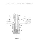 WEDGE KNOTLESS SUTURE ANCHOR diagram and image