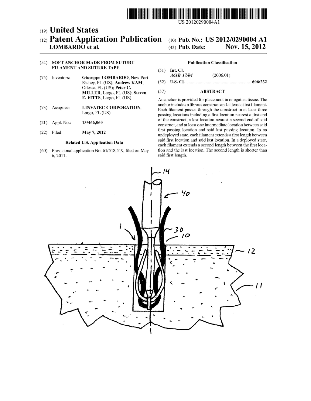 SOFT ANCHOR MADE FROM SUTURE FILAMENT AND SUTURE TAPE - diagram, schematic, and image 01