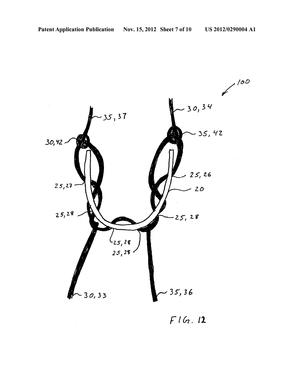 SOFT ANCHOR MADE FROM SUTURE FILAMENT AND SUTURE TAPE - diagram, schematic, and image 08