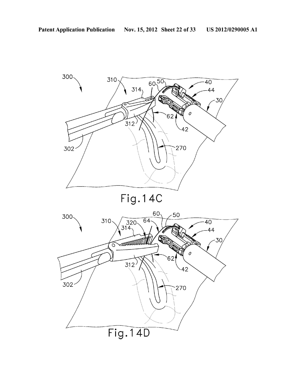 SUTURE FASTENING DEVICE - diagram, schematic, and image 23