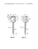 Flexible Screw Head Constructs for Spinal Stabilization diagram and image