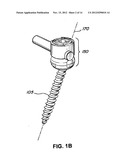 Flexible Screw Head Constructs for Spinal Stabilization diagram and image