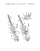 Flexible Screw Head Constructs for Spinal Stabilization diagram and image