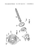 Flexible Screw Head Constructs for Spinal Stabilization diagram and image