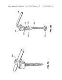 Flexible Screw Head Constructs for Spinal Stabilization diagram and image