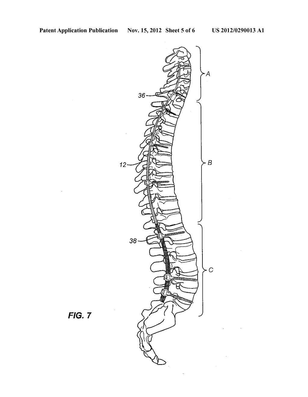 TAPERED SPINAL ROD - diagram, schematic, and image 06