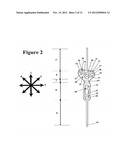 Juxta-articular stabilisation system diagram and image