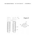 Juxta-articular stabilisation system diagram and image