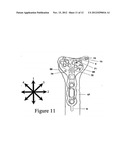 Juxta-articular stabilisation system diagram and image