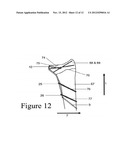 Juxta-articular stabilisation system diagram and image