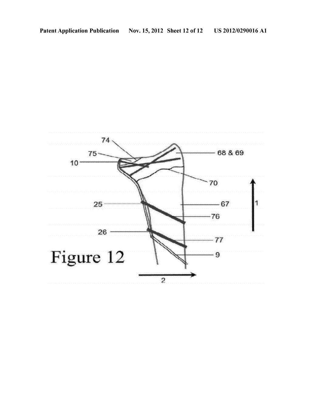 Juxta-articular stabilisation system - diagram, schematic, and image 13