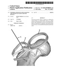 METHODS AND DEVICES FOR VALIDATING THE POSITION OF PATIENT-SPECIFIC     DEVICES diagram and image