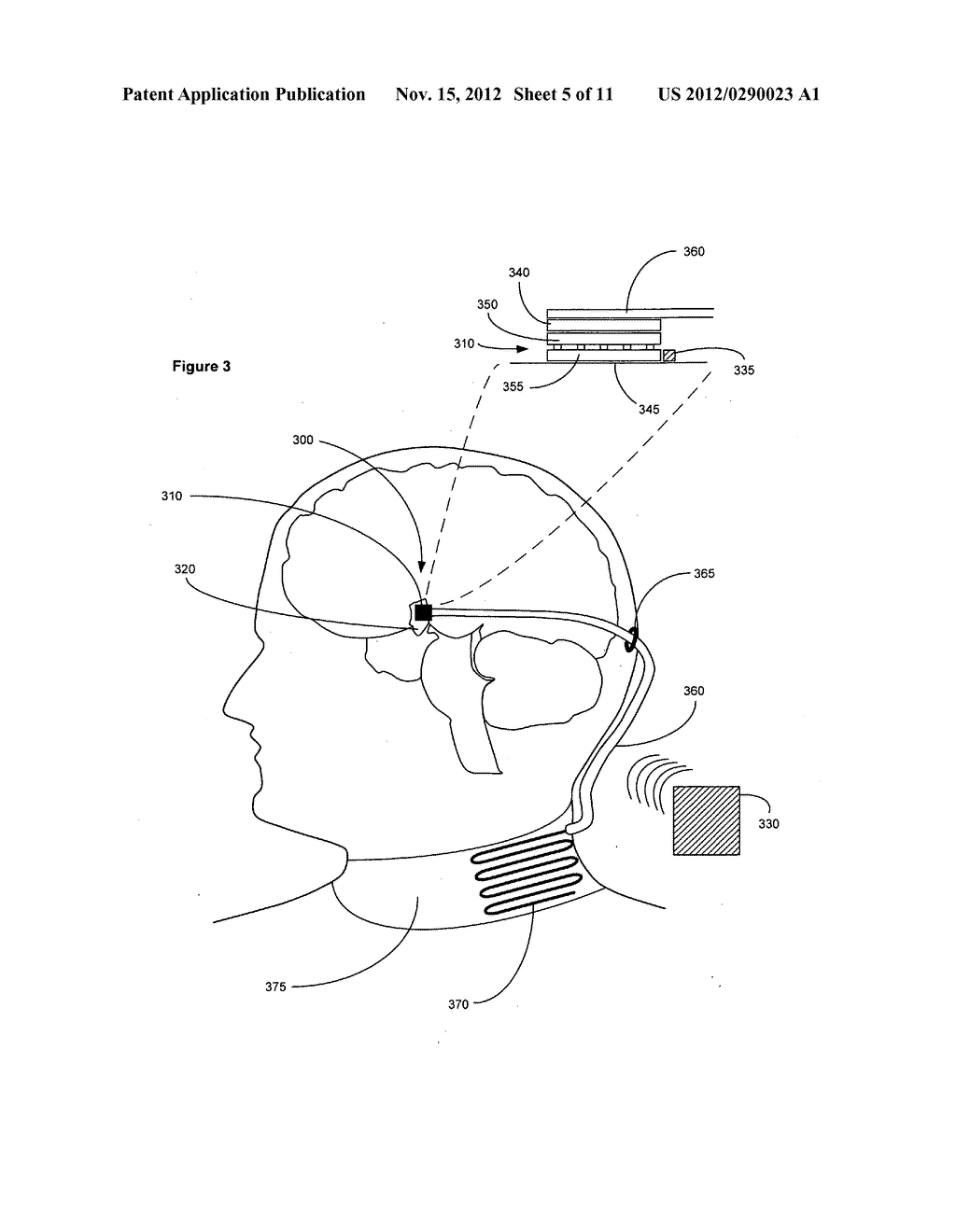 Method, device and system for modulating an activity of brown adipose     tissue in a vertebrate subject - diagram, schematic, and image 06