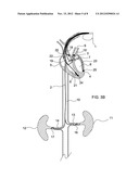 TRANSVENOUS RENAL NERVE MODULATION FOR TREATMENT OF HYPERTENSION,     CARDIOVASCULAR DISORDERS, AND CHRONIC RENAL DISEASES diagram and image