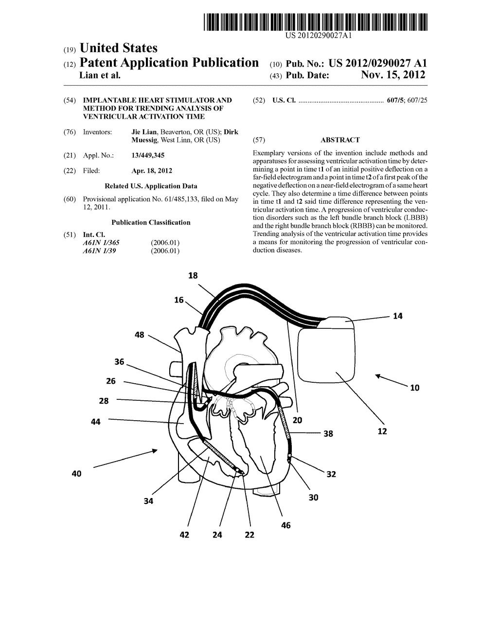 IMPLANTABLE HEART STIMULATOR AND METHOD FOR TRENDING ANALYSIS OF     VENTRICULAR ACTIVATION TIME - diagram, schematic, and image 01