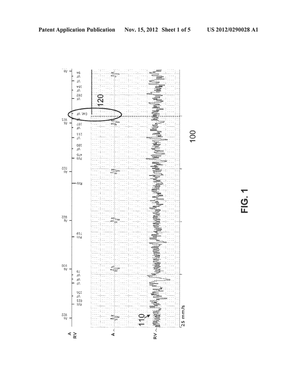 IMPLANTABLE MEDICAL DEVICE WITH ELECTRODE FAULT DETECTION - diagram, schematic, and image 02