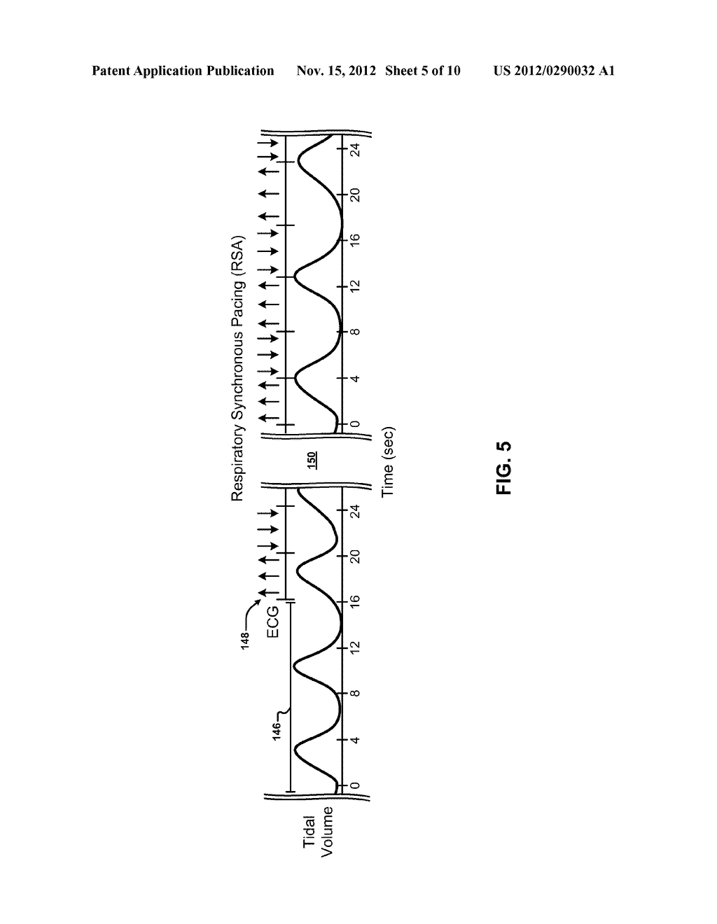 TECHNIQUES FOR MODIFYING BREATHING RATE USING CARDIAC PACING - diagram, schematic, and image 06