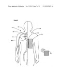 Method, device and system for modulating an activity of brown adipose     tissue in a vertebrate subject diagram and image